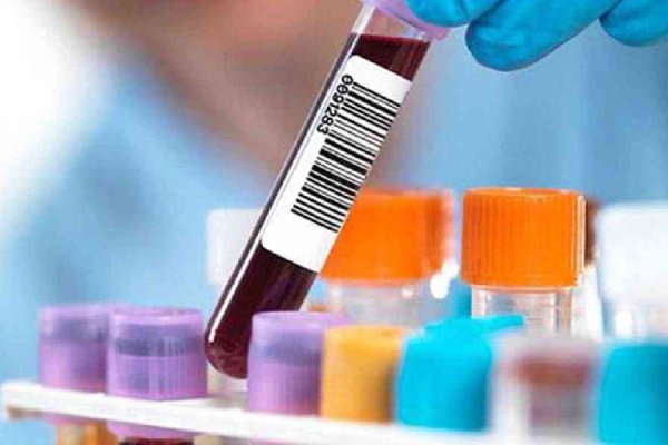 Кракен мониторинг ссылок kraken torion